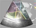 Viola et al. 08: Illustrated Ultrasound for Multimodal Image Interpretation